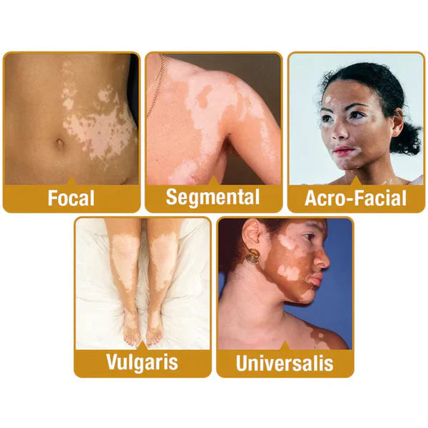 Revitalizing Bee Venom Cream
